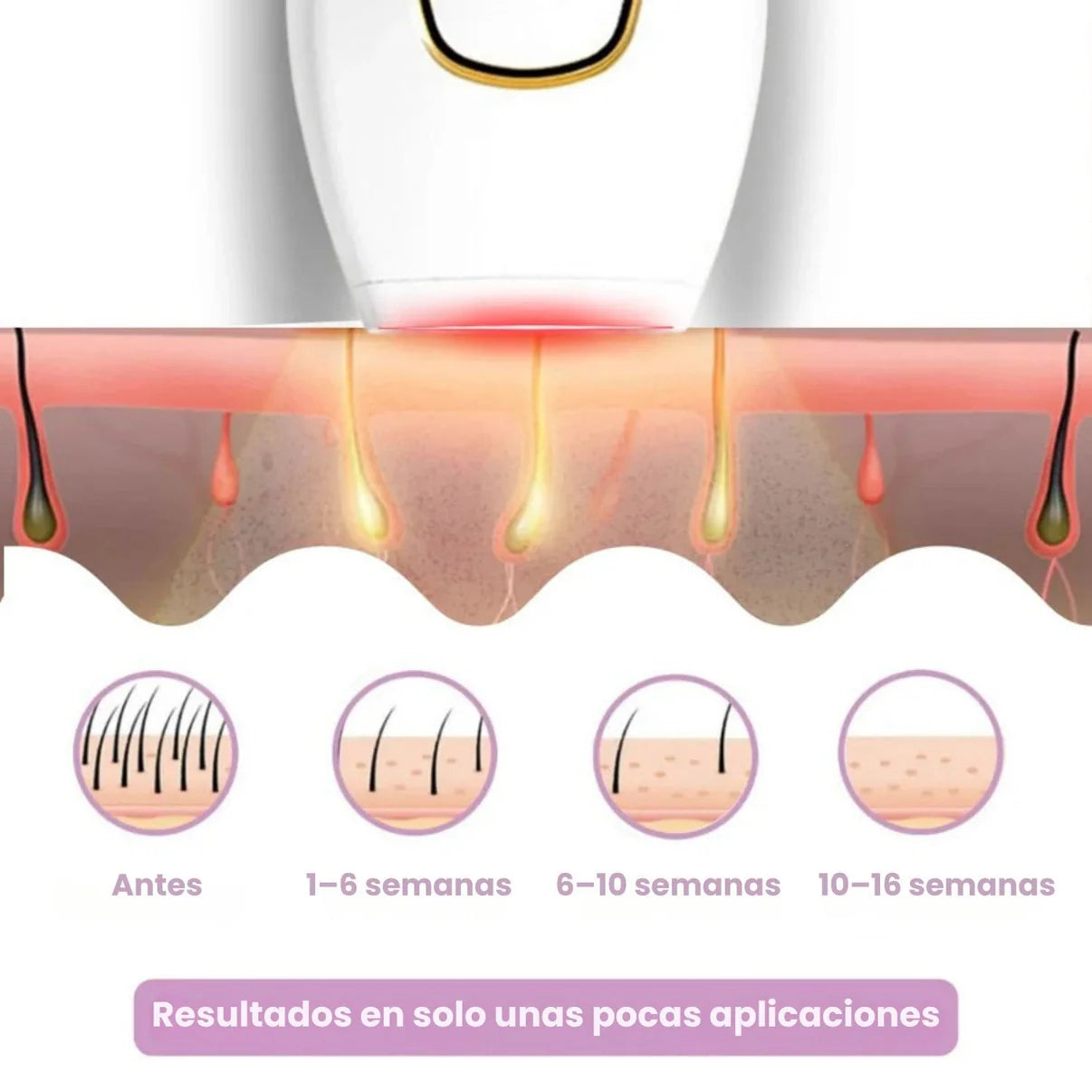DEPILADORA LÁSER PERMANENTE (+ Regalo)