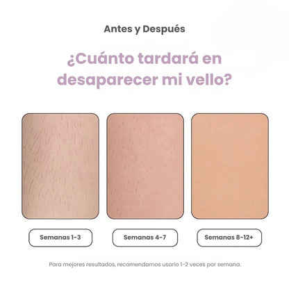 DEPILADORA LÁSER PERMANENTE (+ Regalo)